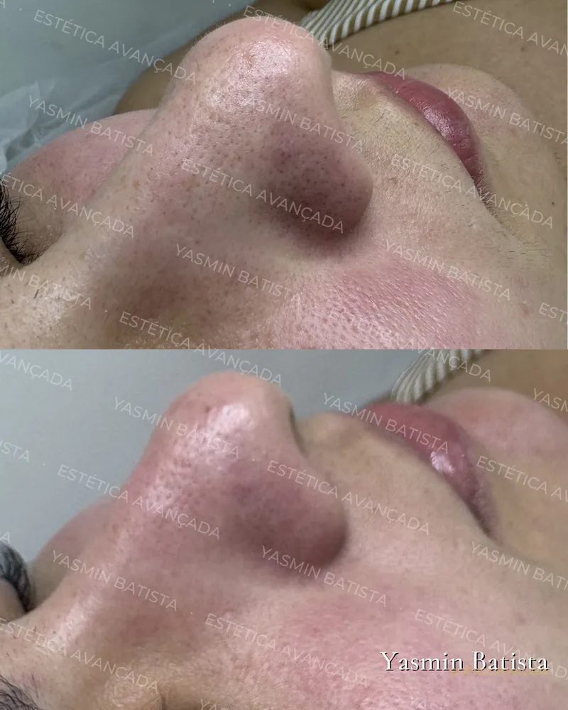 Limpeza profunda — Caso 01